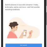 Using AI to help find answers to common skin conditions Using AI to help find answers to common skin conditions